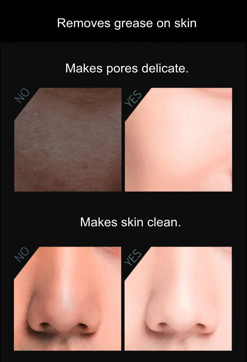 Oil-Absorbing Face Roller